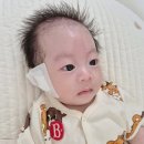 코드텍 | 77일 아기 스킨텍(귀젖) 제거 수술 후기