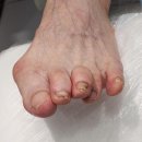 푸스케어 롯데마트제천점 네이버블로그