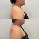 청당초등학교 | 천안바디관리 :: 뉴에스테틱에서 에어바디 등관리 받고 왔어요