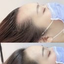 이미지헤어라인 이미지