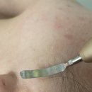 UR(의정부시)-[신흥로]-상-120 | 의정부 피부관리샵 트루에스테틱 추천 후기