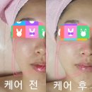 에스케어 이미지