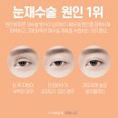 아이니크성형외과의원 이미지