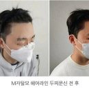 헤드라인유 이미지