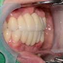 명성치과기공소 이미지