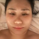 화성봉담 피부관리는 아이마 에스테틱 봉담 피부관리