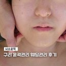 구리 윤곽관리 웨딩관리 서소윤픽 얼굴축소관리 2회차 후기