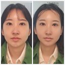 시크릿뷰티# | 강남역 에스테틱 1회 관리로 얼굴 소멸? 강남뷰티 에스테틱 시크릿매직 솔직후기