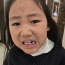 연세꿈꾸는아이치과의원 | [위례 어린이치과] 유치 발치 잘하는 곳 연세꿈꾸는아이치과의원 송파위례점-내돈내산
