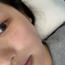 김해 - 김해시 김해대로 2669 | 부산 포텐자 펌핑팁 쥬베룩 스킨 김해 피부과 후기