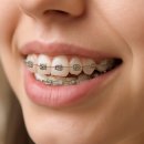 송도치과의원 | 치아 건강을 위한 송도교정치과 방문 후기