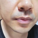 주식회사 본팜 네이버블로그