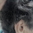 청음 독일보청기 이미지