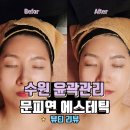 문피연 - 수원시 영통구 법조로149번길 82 | 수원윤곽관리 잘하는 문피연 에스테틱 광교피부관리 받고왔어요