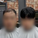 【서울 관악구 남자가발전문점】 잘하는 미용실 추천과 고르는 꿀팁 리뷰 가발후기