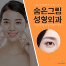 숨은그림성형외과