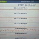 은하부분정비 이미지