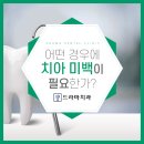더하얀치과 이미지