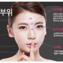 조세흠성형외과 네이버블로그