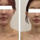 힐링 짱 피부관리