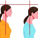 정릉바로척의원 | 거북목 증후군 정릉바로척의원에서 상담하세요