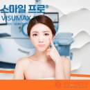 스마일 | 대전스마일라식 후기, 난시 교정까지 완벽하게!