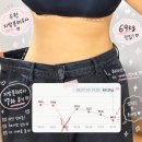 69 | 수원지방분해주사 7차 후기 드디어 69kg대 진입!