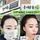 홍대 헤어라인 두피관리 확실한 Before &amp; After 리얼후기 리터치까지 SMP두피 홍대살롱