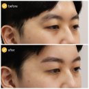 아나덴슈가링왁싱신논현역점