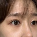 니드유브로우 네이버블로그