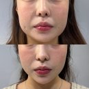 경락마사지 이미지