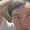 이마점성형 가경동 성형외과 엄청 큰 점 제거 수술 후기 1일차 ~ 3일차