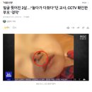 얼굴 찢어진 2살…“놀다가 다쳤다”던 교사, CCTV 확인한 부모 ‘경악’ 이미지