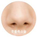 이명철성형외과 이미지