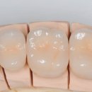 자연치과기공소 이미지