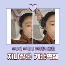 기흥역 미용실 지니살롱에서 두피클리닉 받고 온 후기