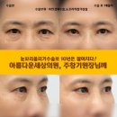 예쁜세상성형외과의원 네이버블로그