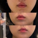 제일약초 | 일산 피부관리 더맑은스킨 일산장항점 약초필 리얼후기 A-Z 생생한 과정