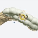애플치과기공소 이미지