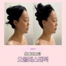 마미에스테틱 | 광주피부관리 온다리프팅 잘하는 곳, 오월에스테틱 솔직후기
