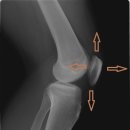 간단한 테이핑 및 마사지 이미지