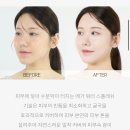 랑끄