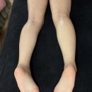 올리비아로렌(부천남부점) | [부천역 바디관리샵] 부천 하체순환관리 찐후기, 다리 붓기 싹 빠진 ‘고운피부바디샵’