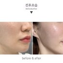 고은인셀덤