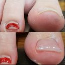 풋솔루션 이미지