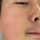 메티의원 네이버블로그