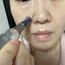 셀프 MTS 후기 _ 오아조 3D MTS 더마 부스팅샷