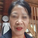 거울 속 깊어진 그늘, 조명 아래서 더 선명해 보인다면? 팔자주름후기 보고 결정하세요 | 유투성형외과
