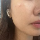 디지털스킨 | 구로디지털단지역피부과 스킨부스터후기