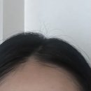 동탄산단5길L | 2동탄 두피관리, 프라이빗 한 올뷰티유에서 모발생장술 받은 후기